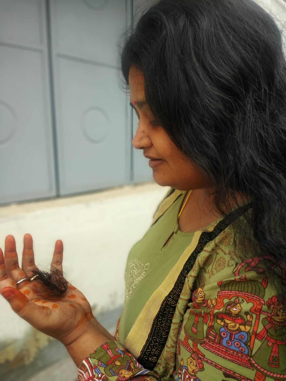 Post Covid Hairfall and Remedies!!