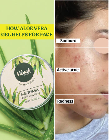 aloe vera gel for face
