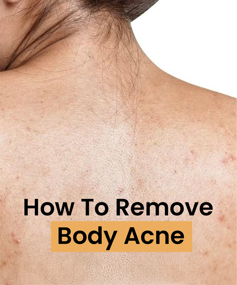 how to reduce body acne
