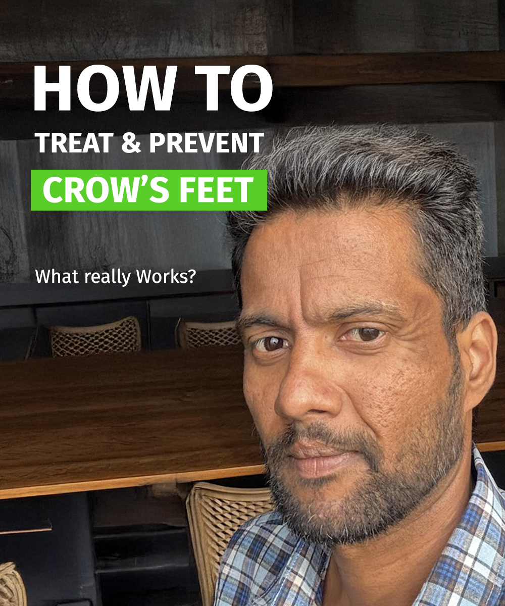 how to remove and prevent crows feet