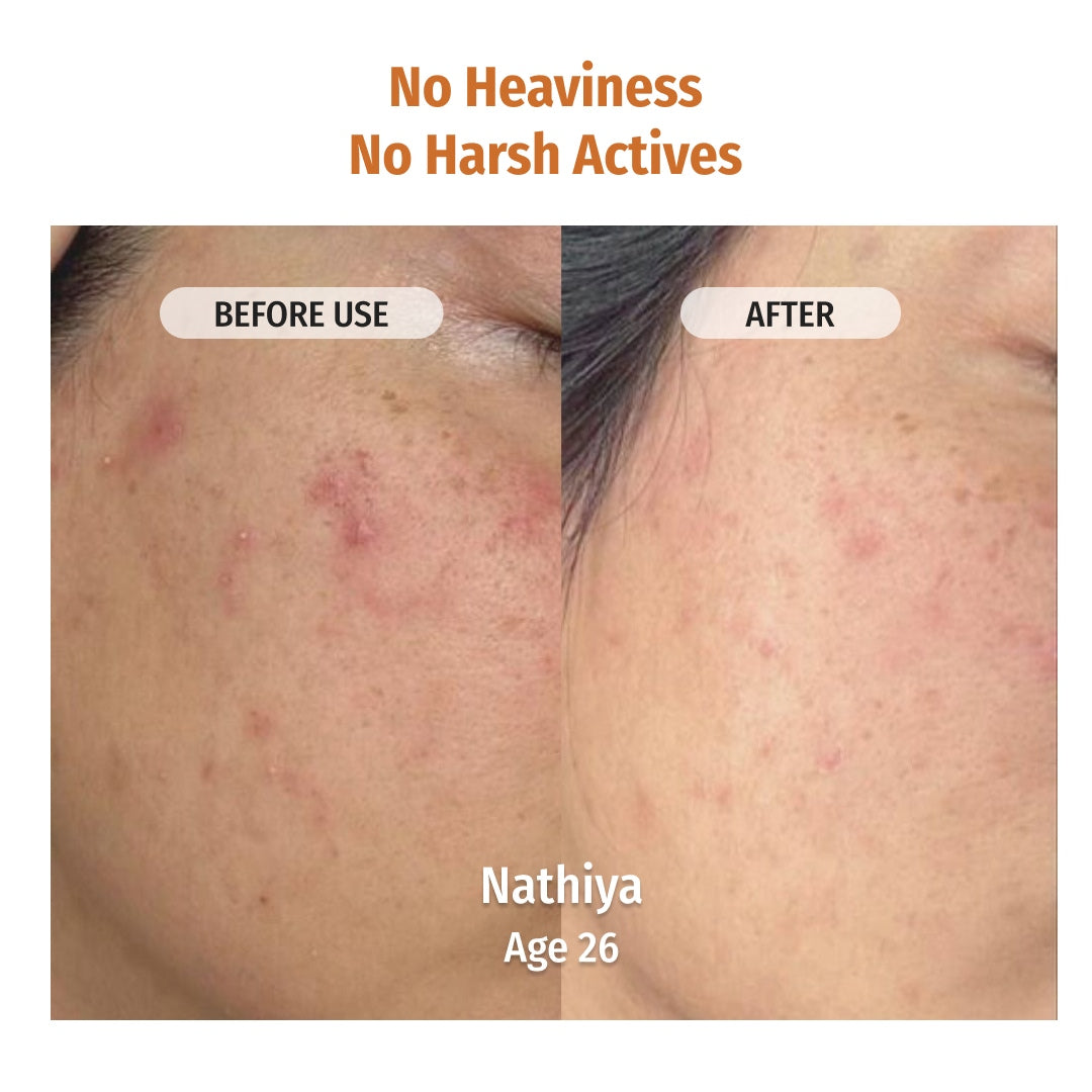 vilvah ultra moisturising cream has no heaviness and harsh actives
