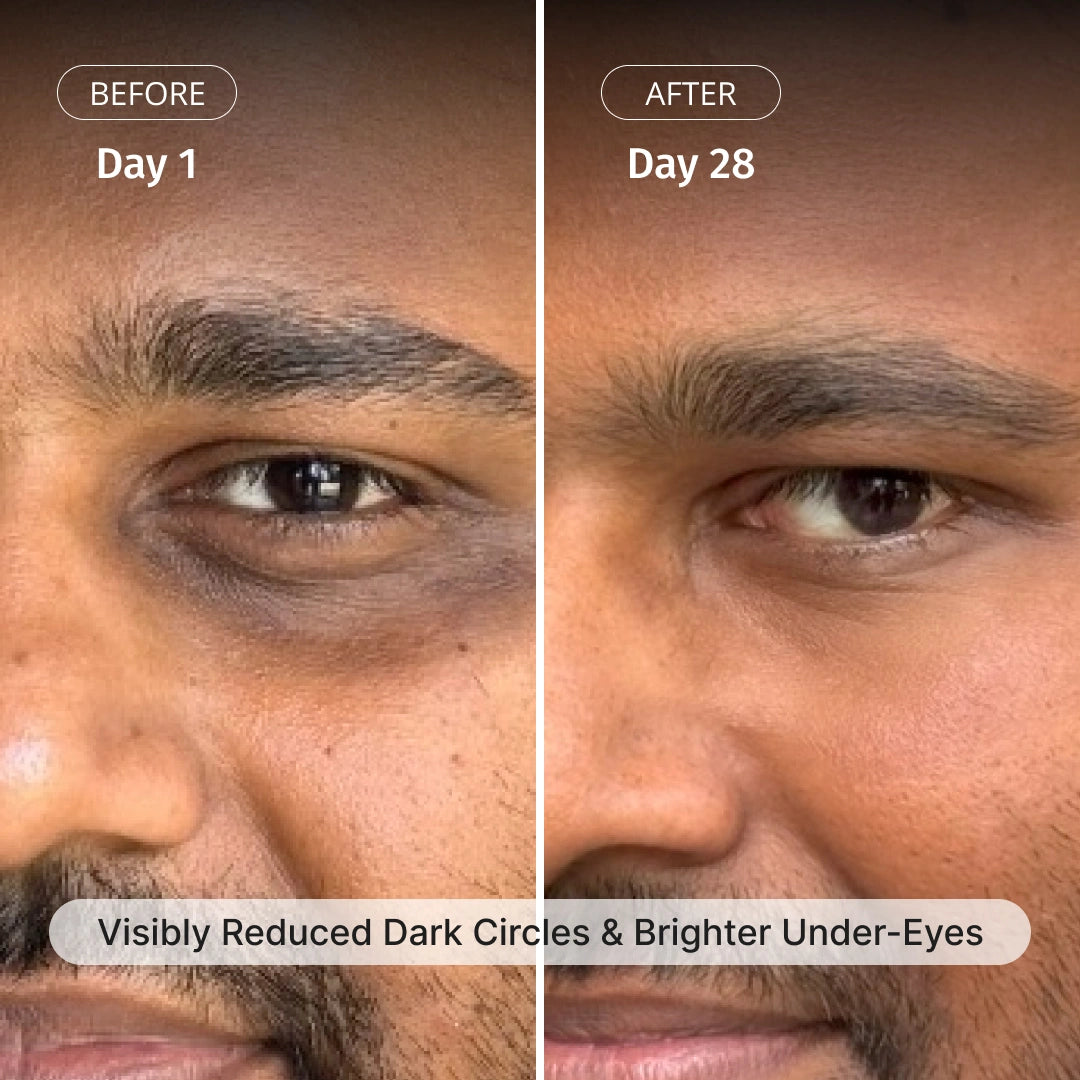 Advanced Under Eye Cream