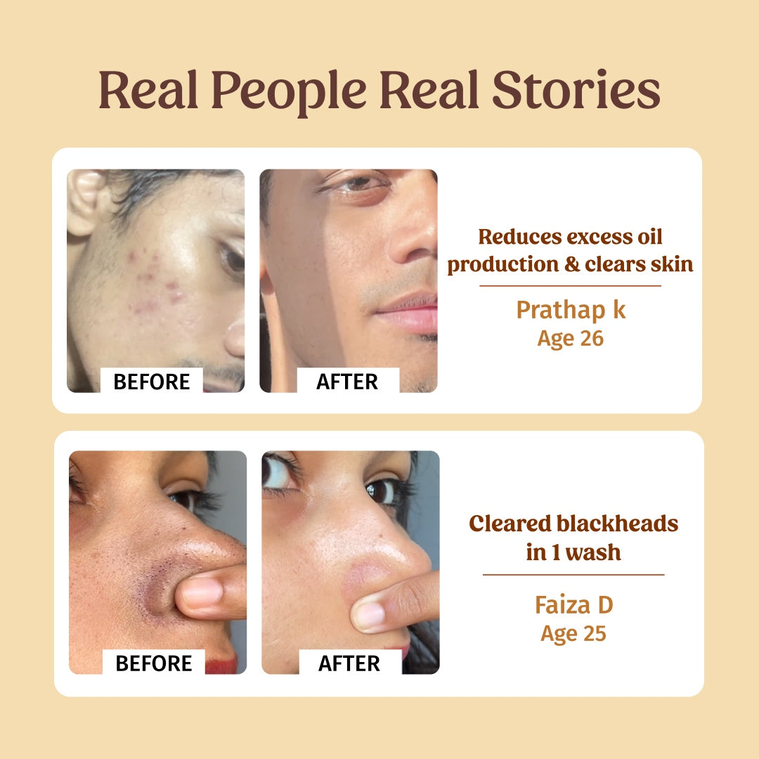 Pore Minimising Combo