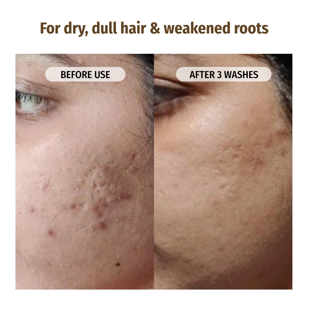 Sensitive Skin Combo