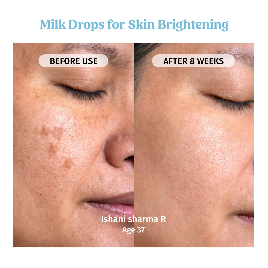 vilvah milk drops serum for skin brightening