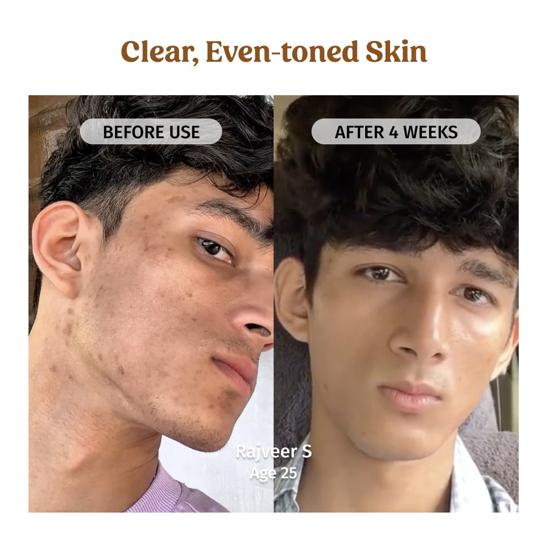 vilvah milk drops serum clear, even-toned skin