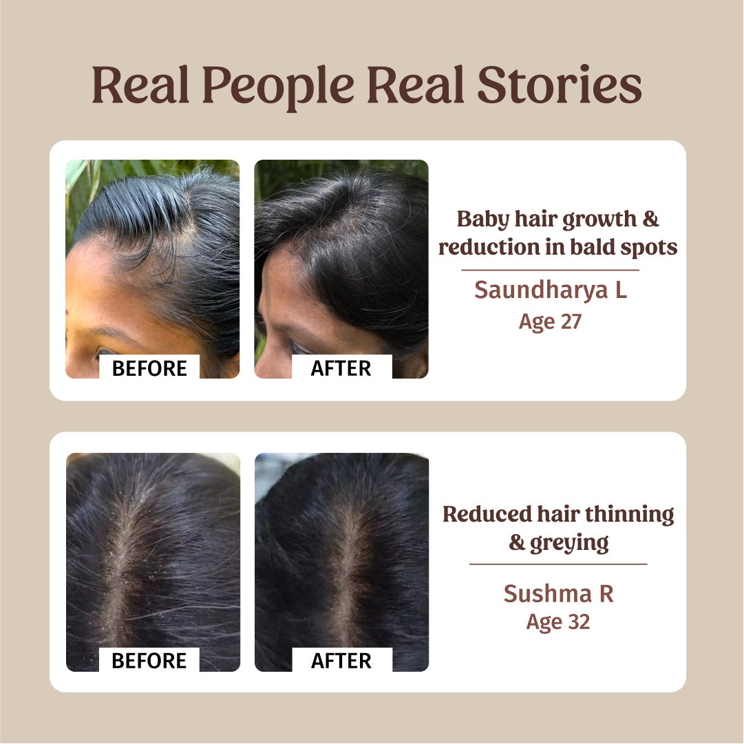 Hairfall Control Combo