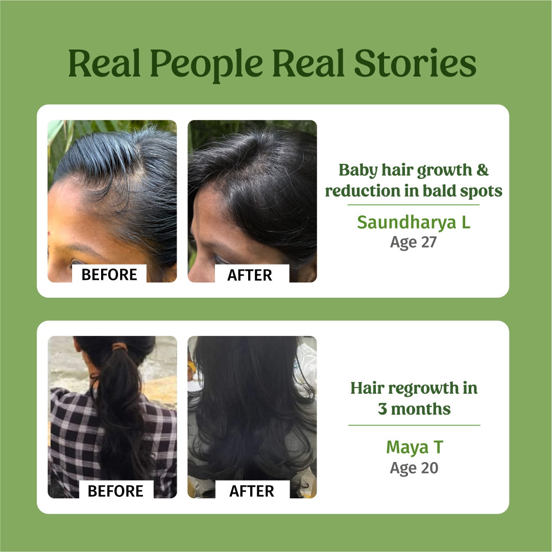 before and after using vilvah hair growth oil