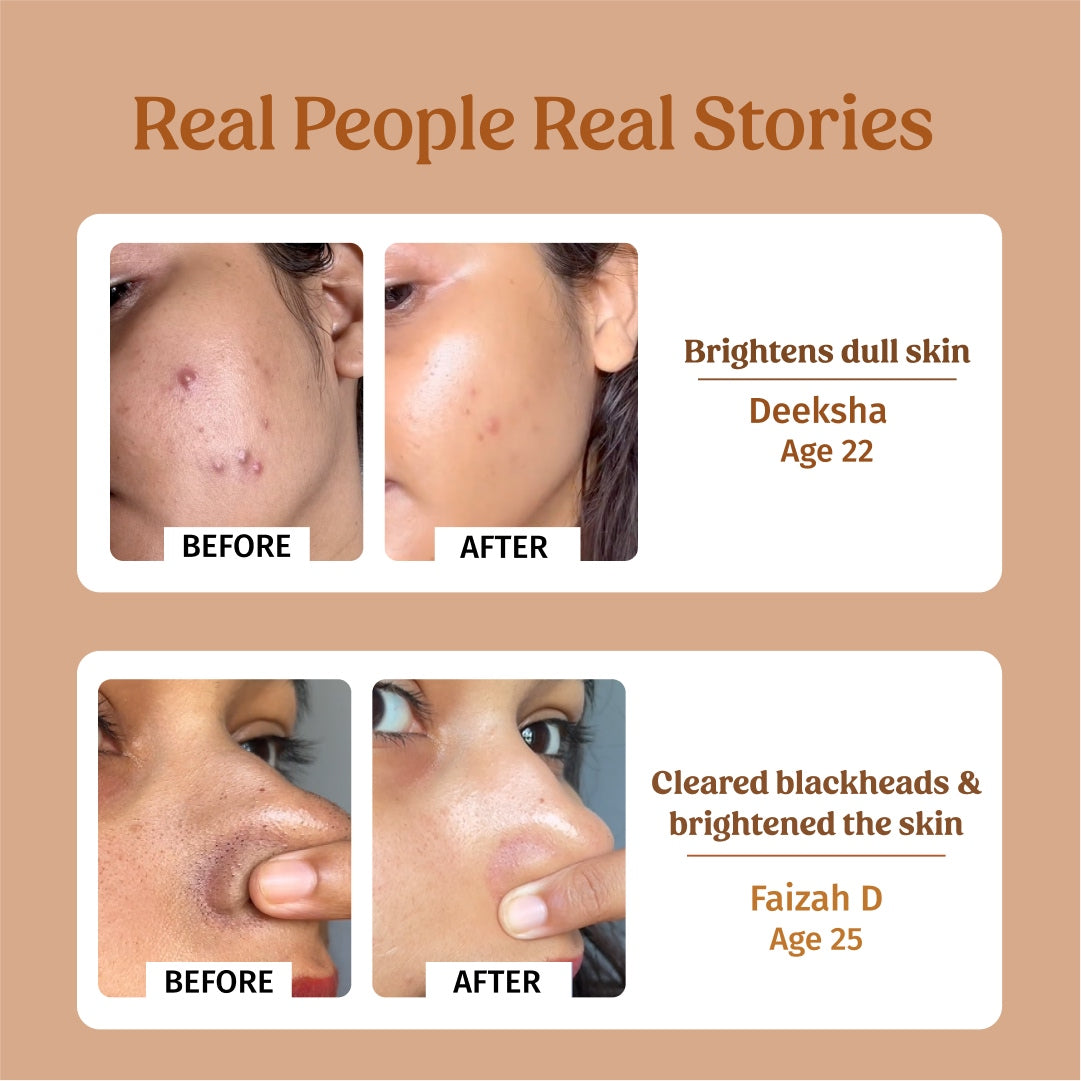 Before and After using Vilvah Face Brightening Combo