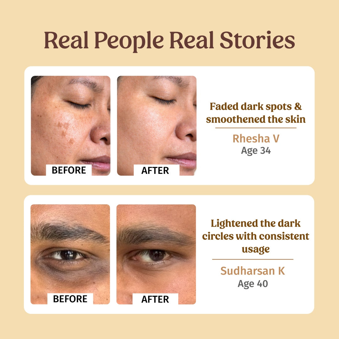 before and after using vilvah face lift combo