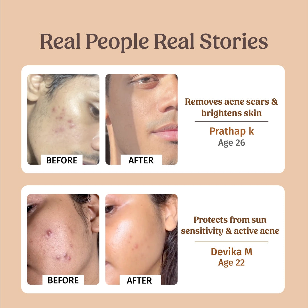 before and after using vilvah skin brightening combo