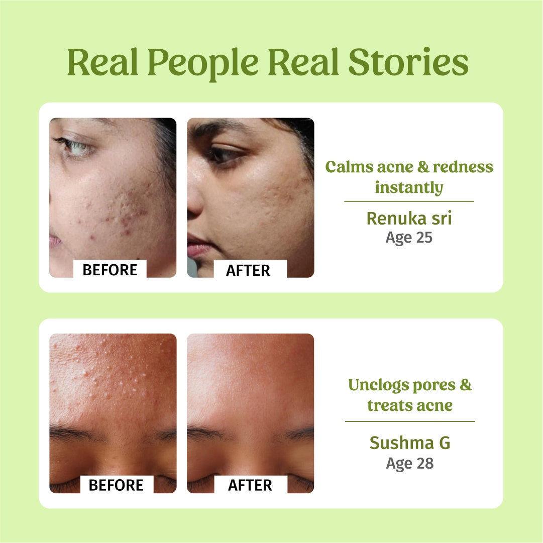 before and after Vilvah Sensitive Skin Combo