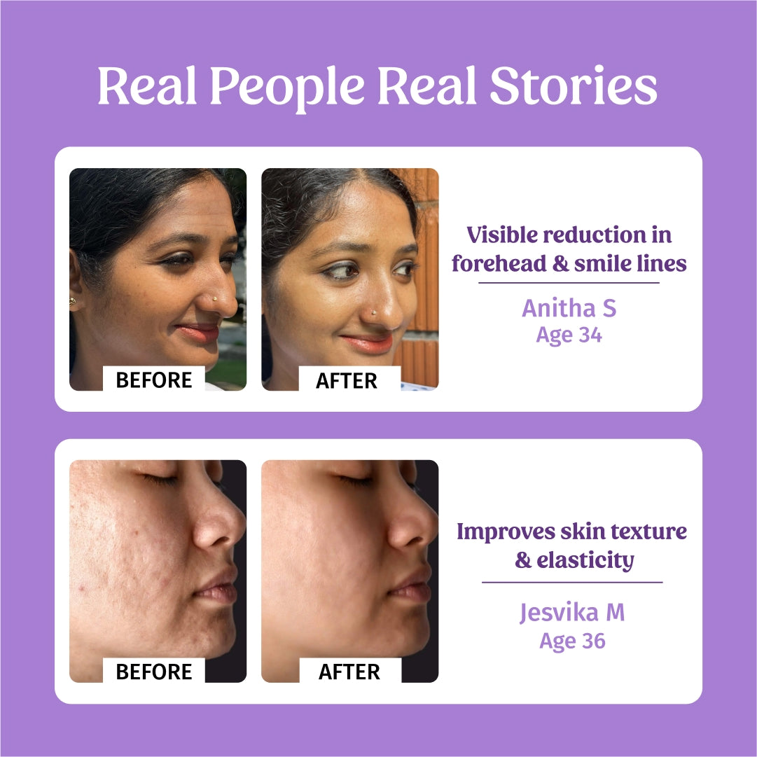 before and after using vilvah 40ml better ageing serum