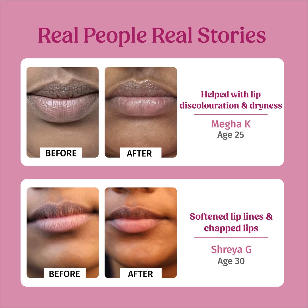 before and after using vilvah grapefruit lip balm