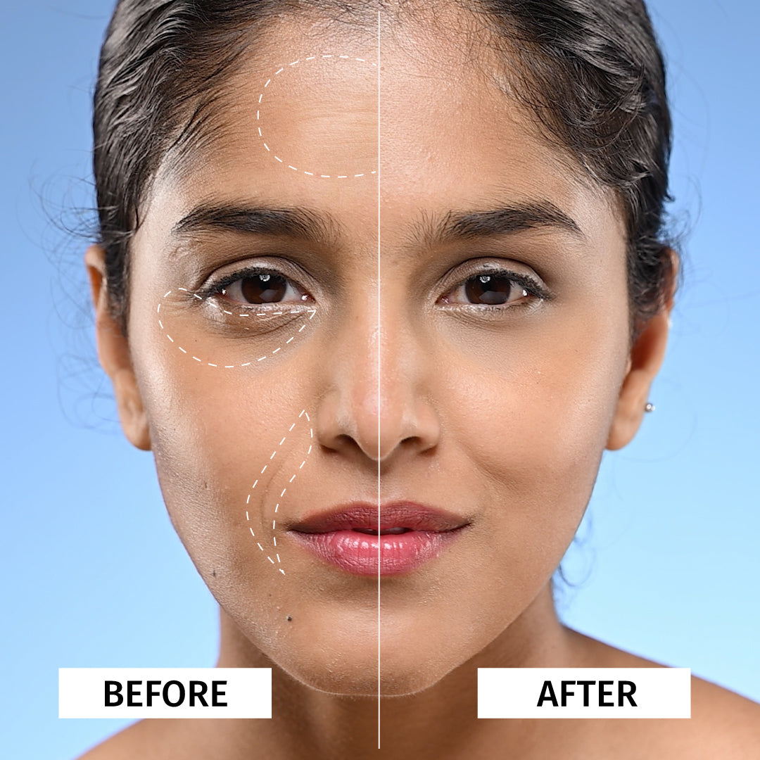 before and after of using the best serum for face anti aging - Vilvah