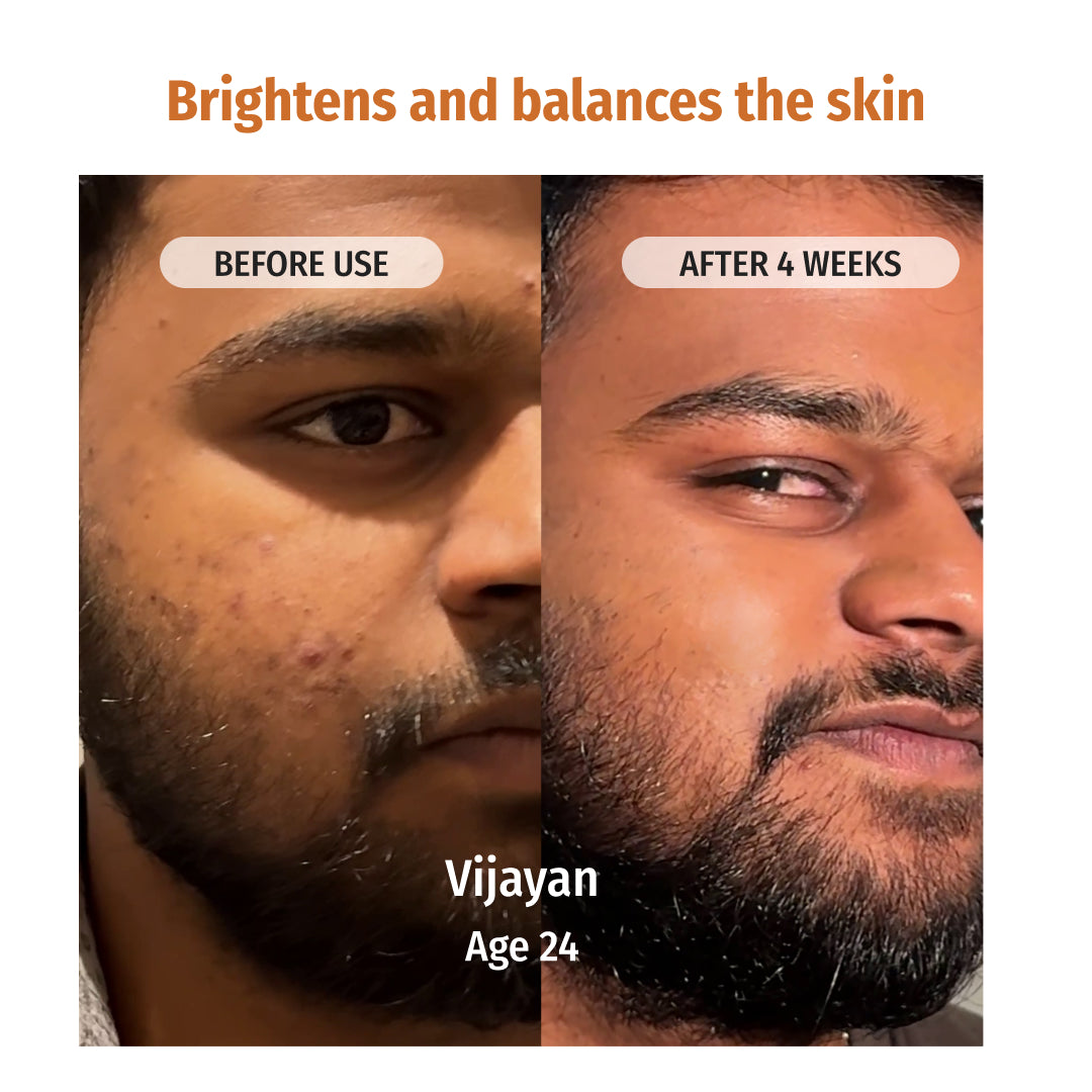 vilvah face brightening combo brightens and balances the skin