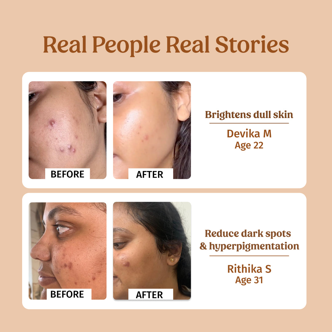 Milk Drops Brightening Serum