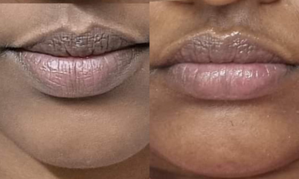 Before and after using Vilvah's grapefruit lip balm