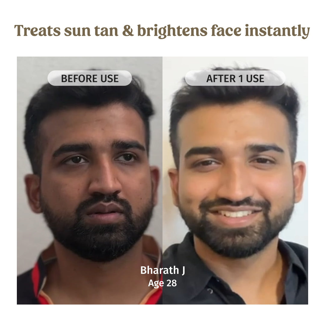 Before and After using Vilvah Milk Mud Mask