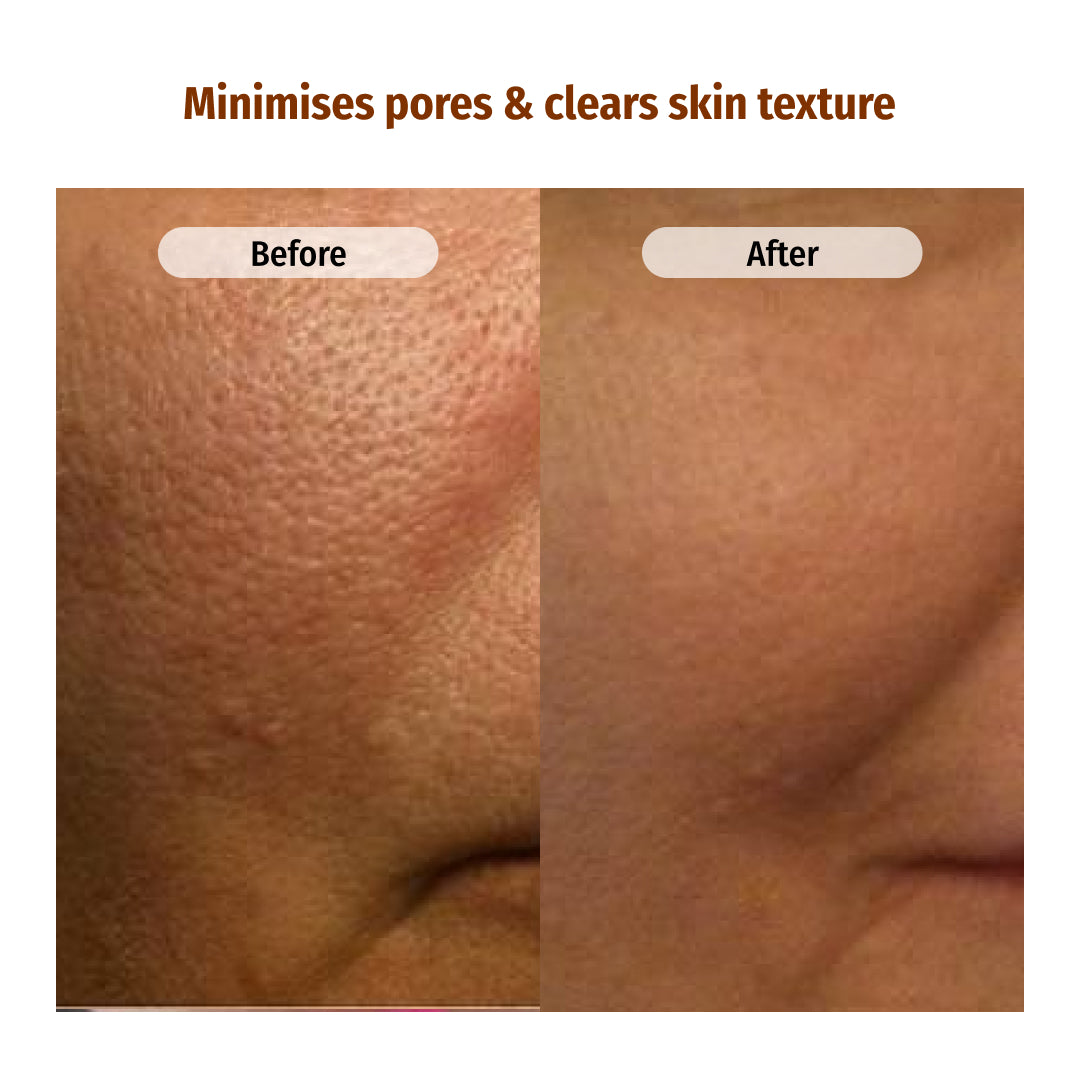 vilvah milk face toner minimises pores and clears skin texture