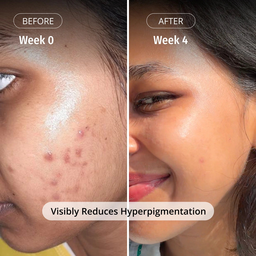 Milk Drops Brightening Serum