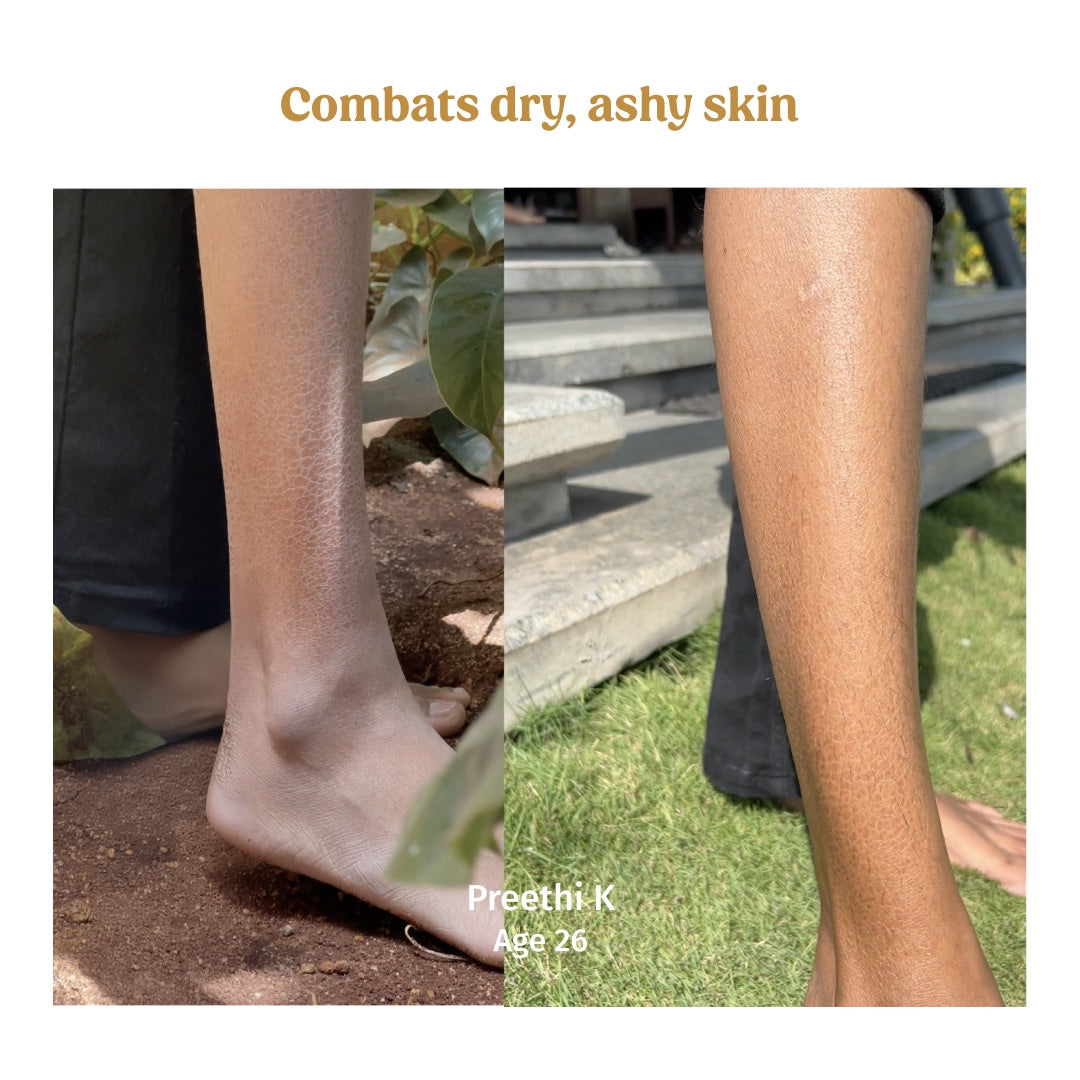 vilvah milk body lotion combats dry and ashy skin