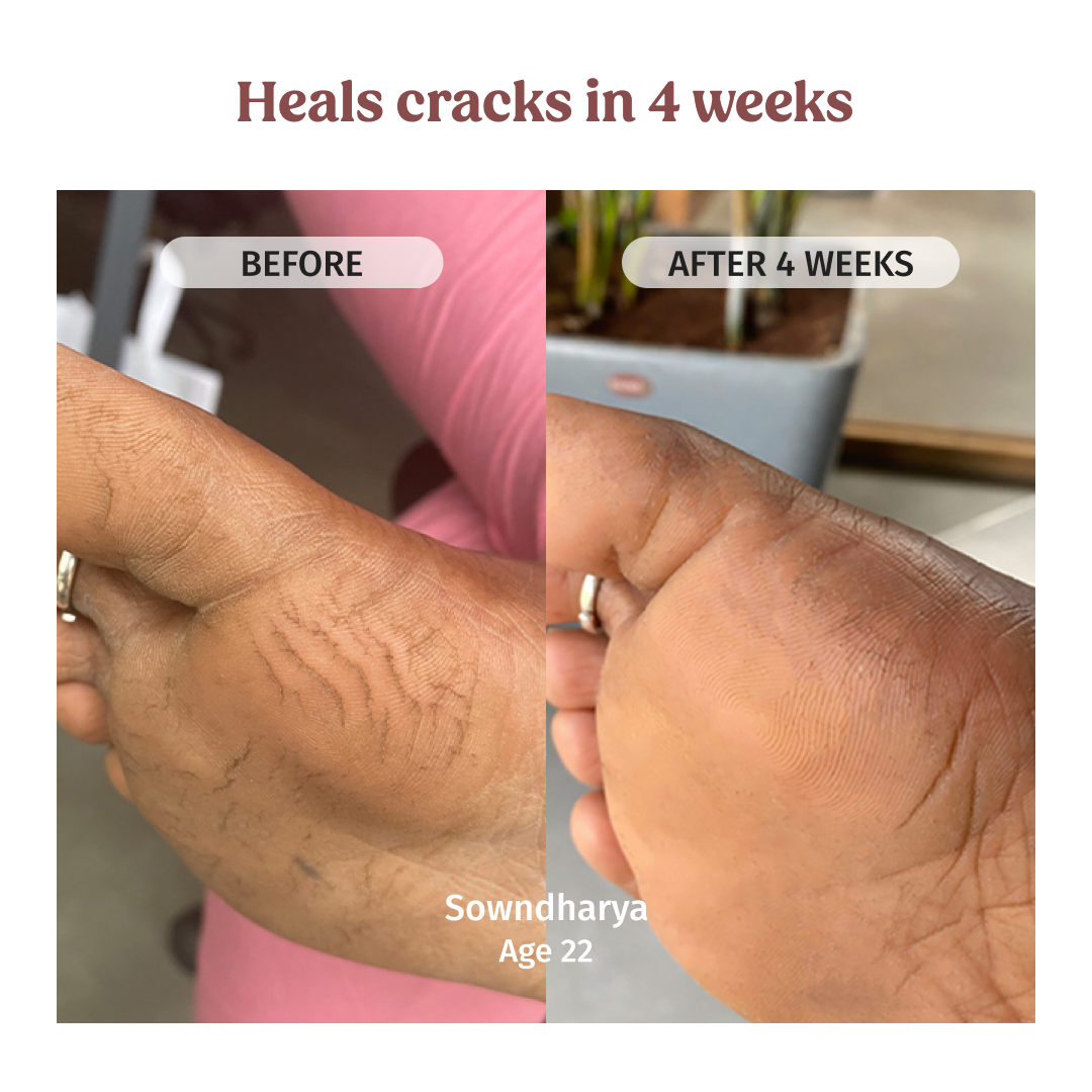 Foot Cream