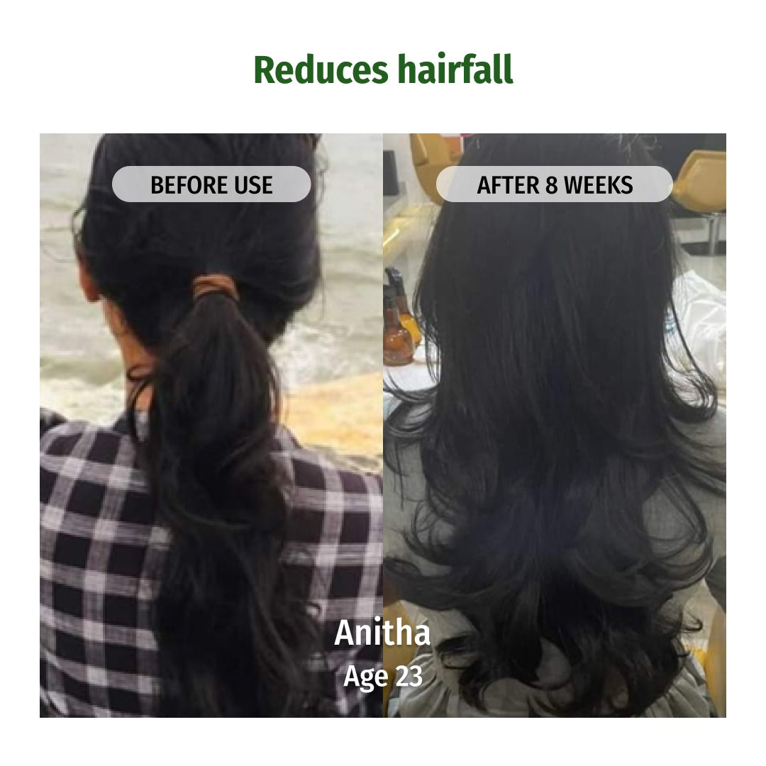 vilvah hair regrowth oil reduces hairfall