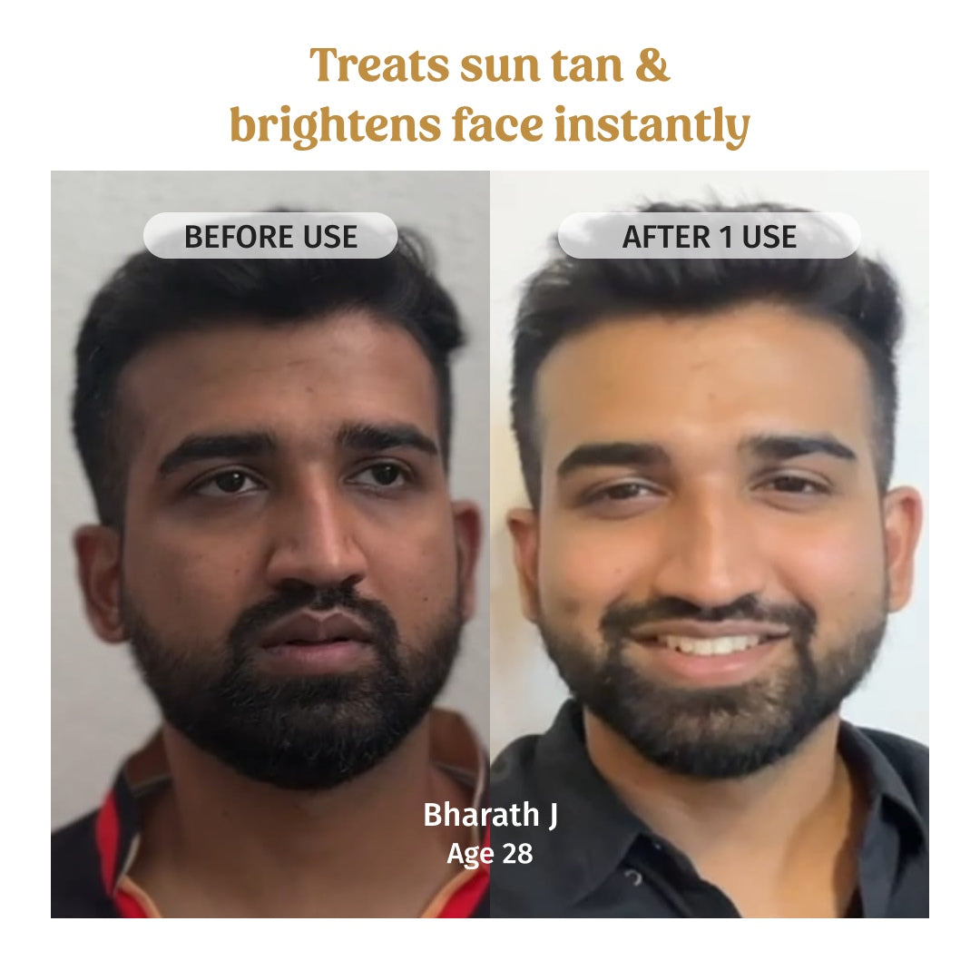 Vilvah Skin Glow Combo treats sun tan and brightens face instantly