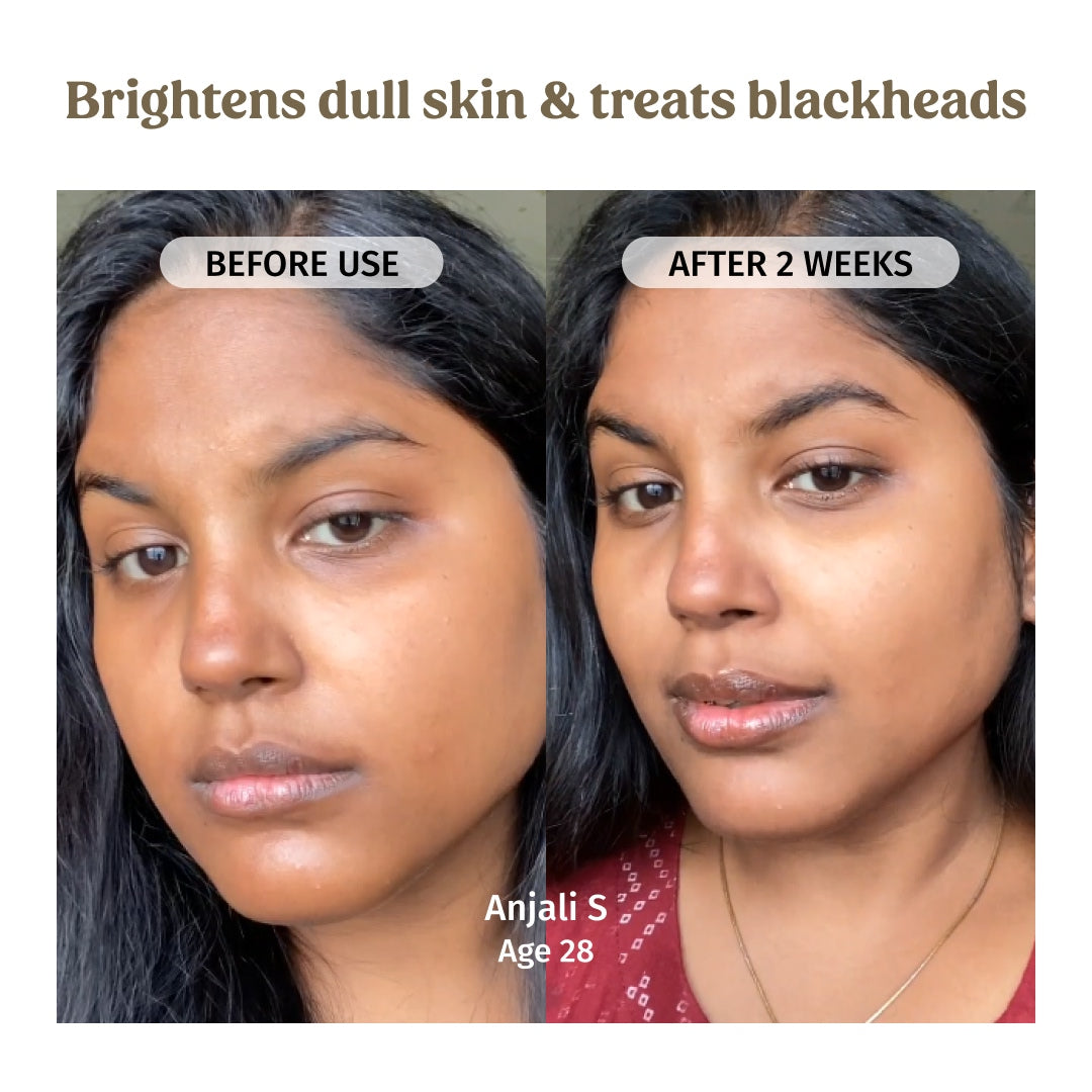 Vilvah Milk Mud Mask brightens dull skin and treats balckheads