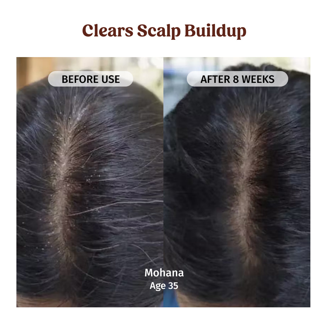 vilvah herbal shampoo
clears scalp buildup