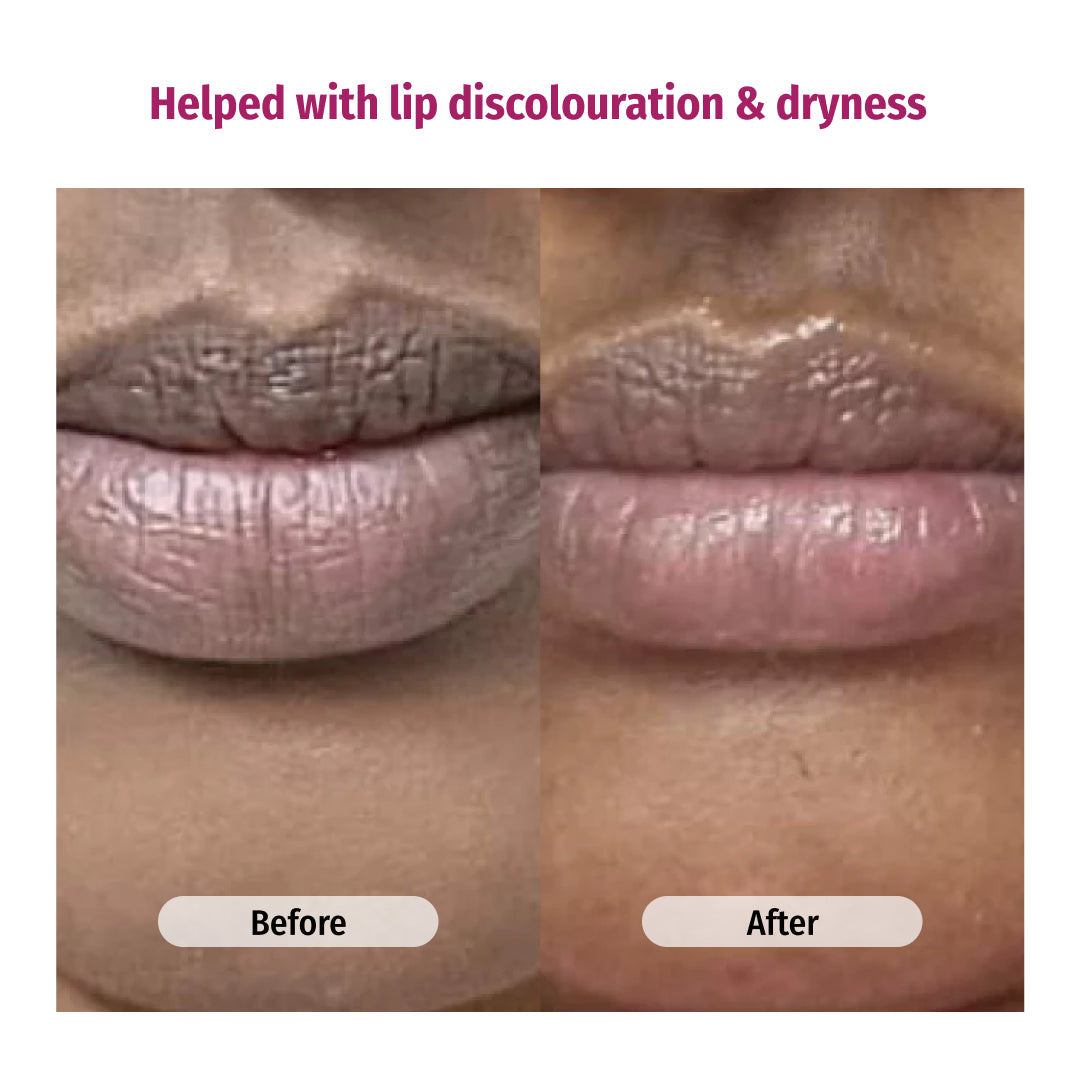 vilvah grapefruit lip balm heals lip discolouration and dryness