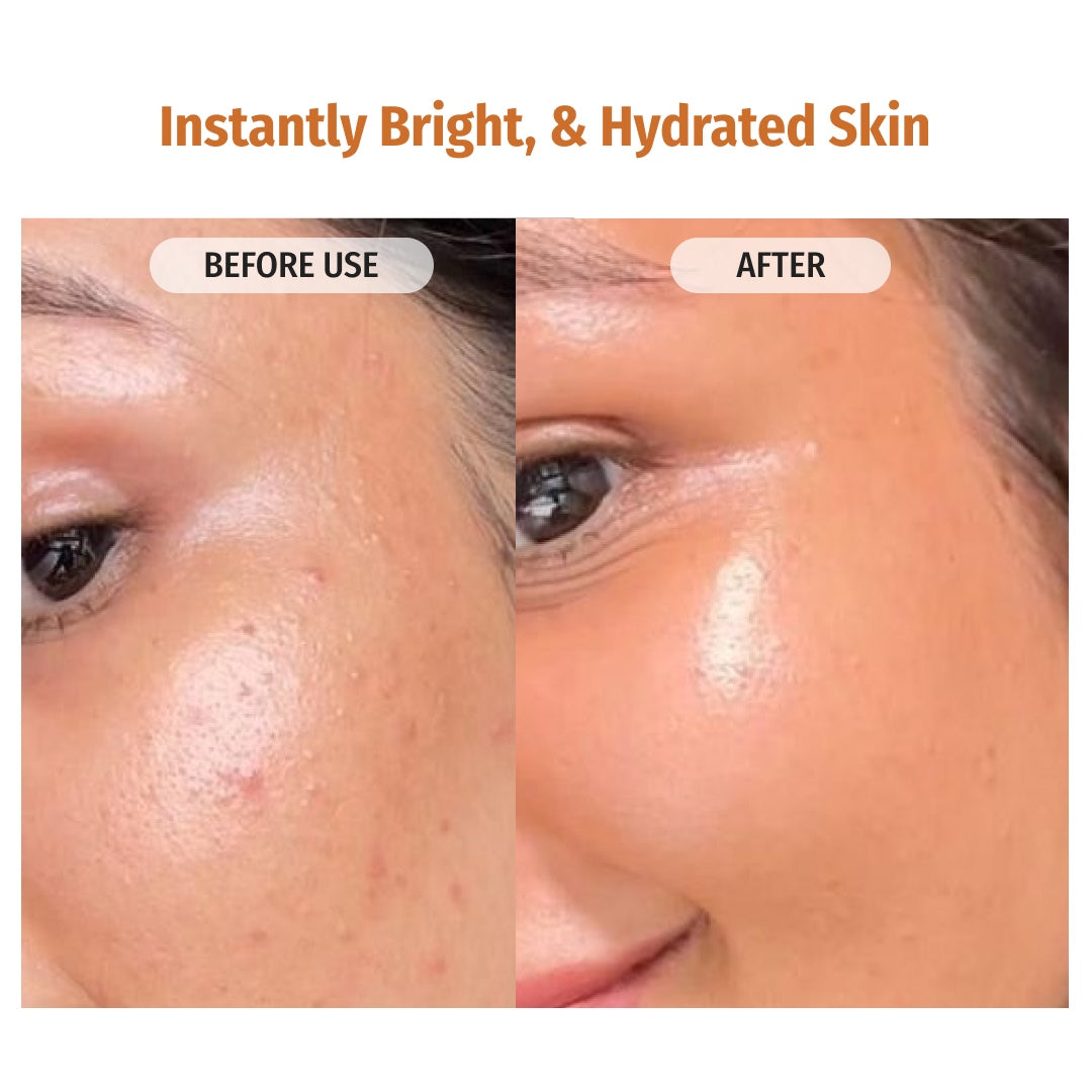 Vilvah Face Lift Combo Instantly Bright & Hydrated Skin