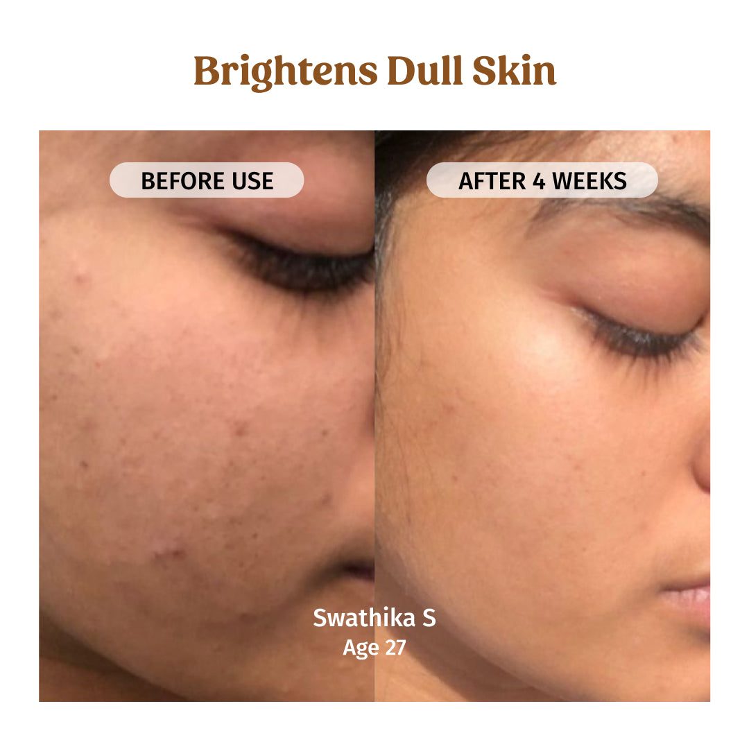 before and after using milk drops brightening serum - brightens dull skin