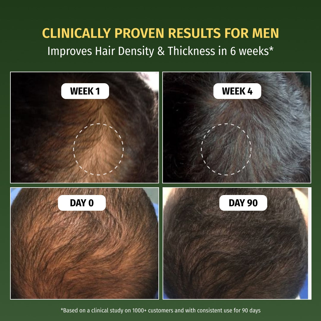 Hair Growth Serum
