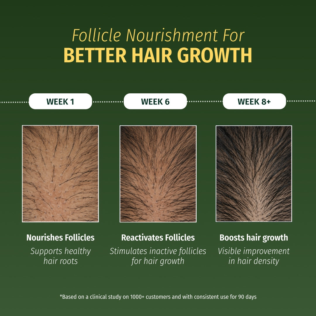 Hair Growth Serum