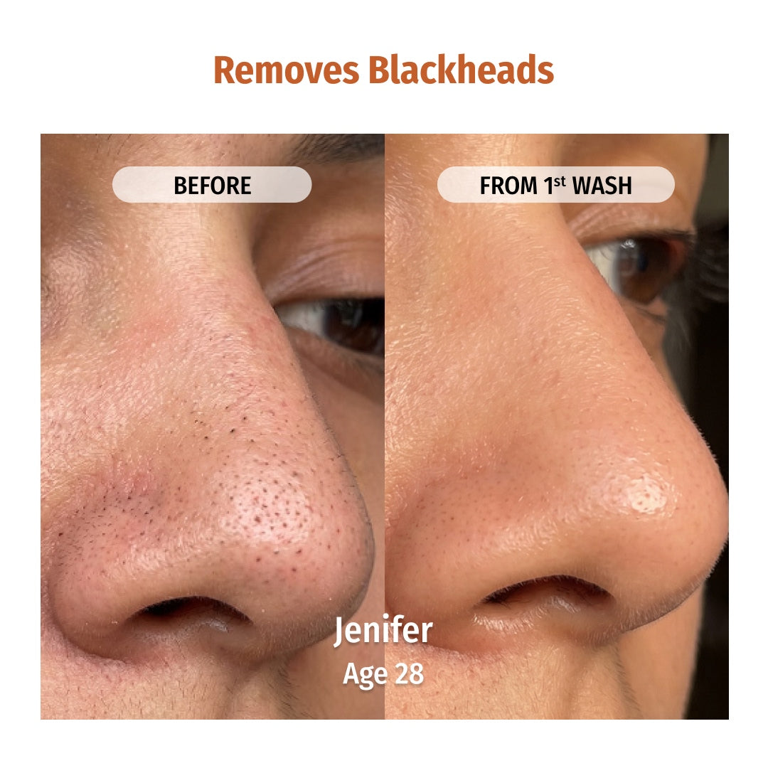 vilvah milk powder face wash removes blackheads