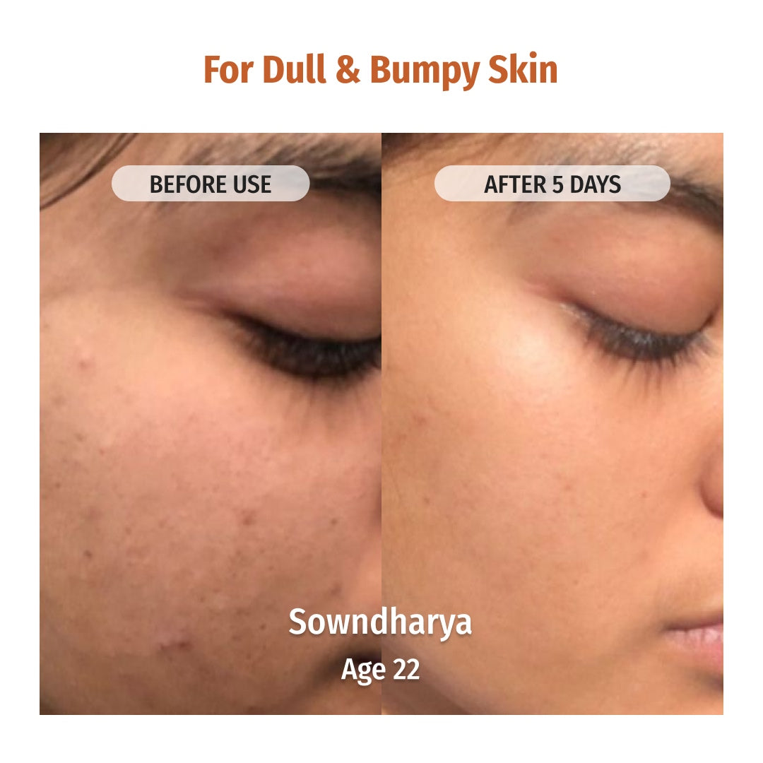 vilvah milk powder face wash reduces dull and bumpy skin