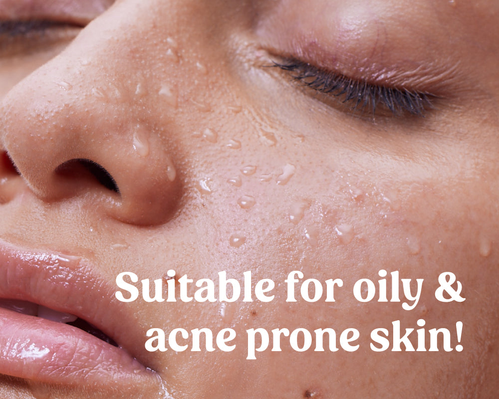 milk face toner for oily and acne prone skin