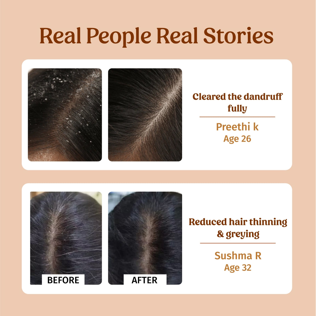 before and after using Vilvah herbal shampoo
