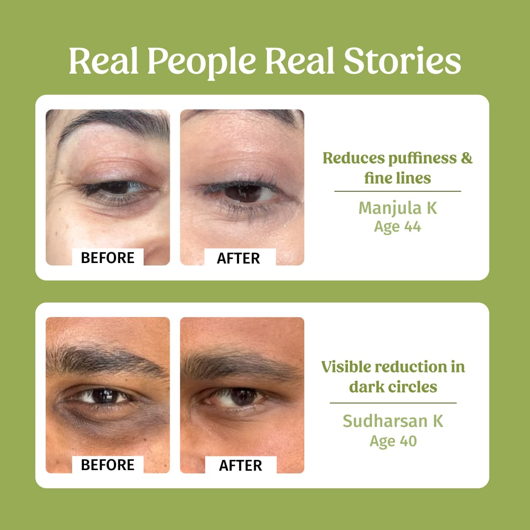 before and after using under eye cream Vilvah