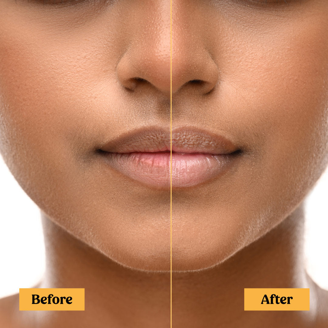 Before and after using milk lip balm SPF 30 PA+++ Vilvah