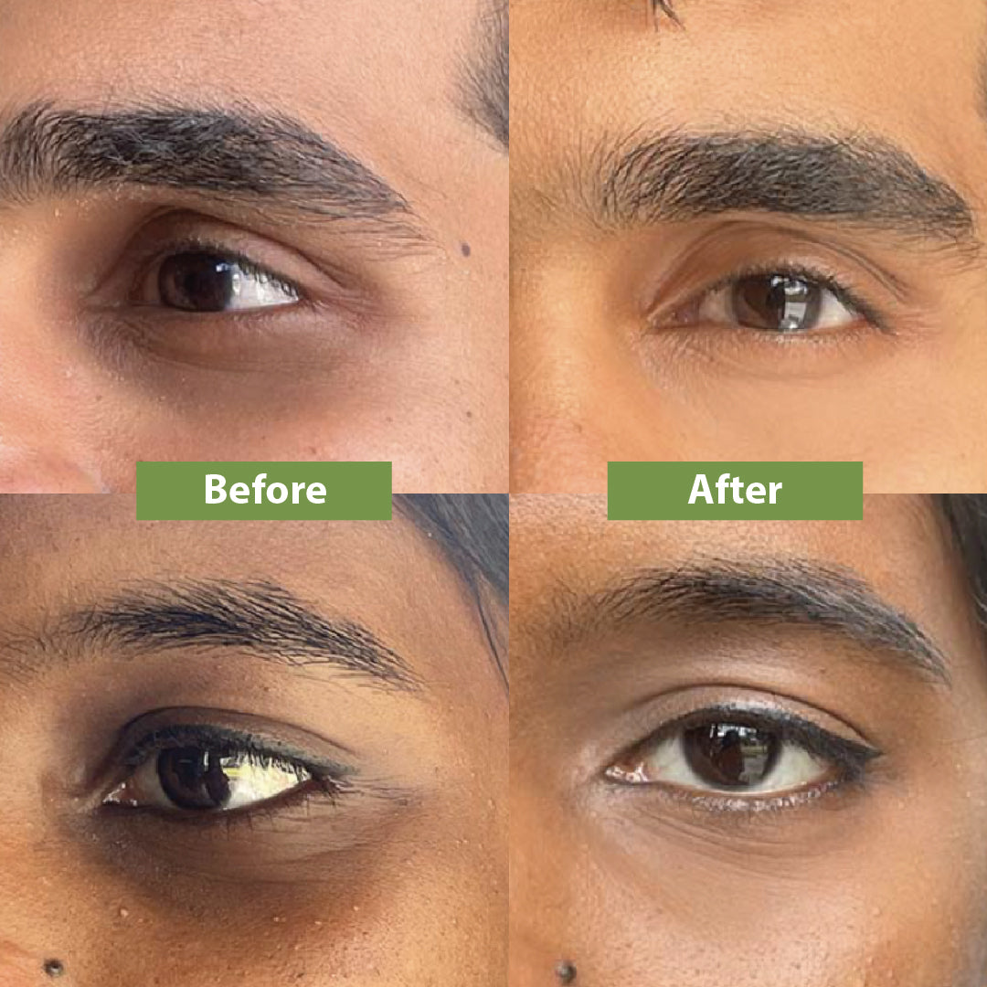 before and after using under eye cream - Vilvah