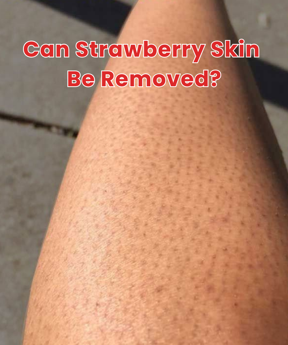 can strawberry skin be removed