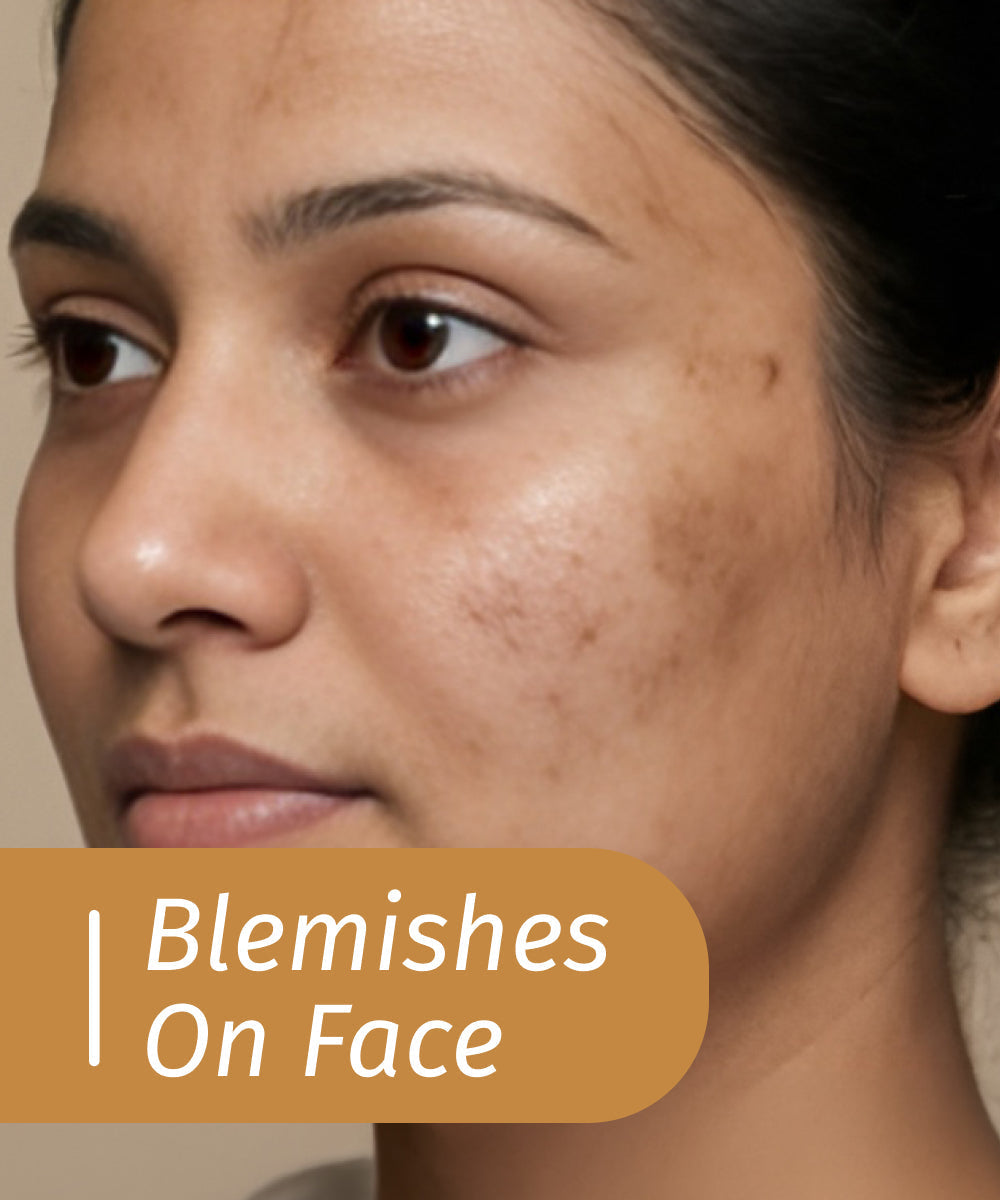 blemishes on face