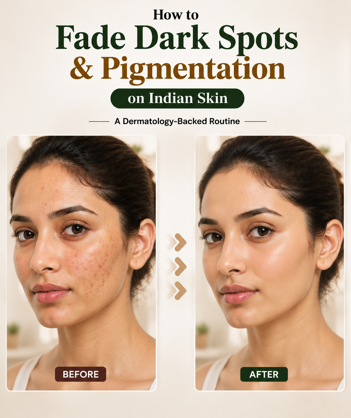 Skincare routine for dark spots and pigmentation on Indian skin.
