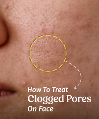 How To Get Rid Of Clogged Pores On Face?