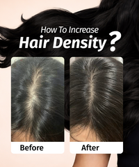 Increase Hair Density & Get Thicker, Fuller Hair Naturally