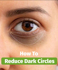 How To Reduce Dark Circles Naturally?