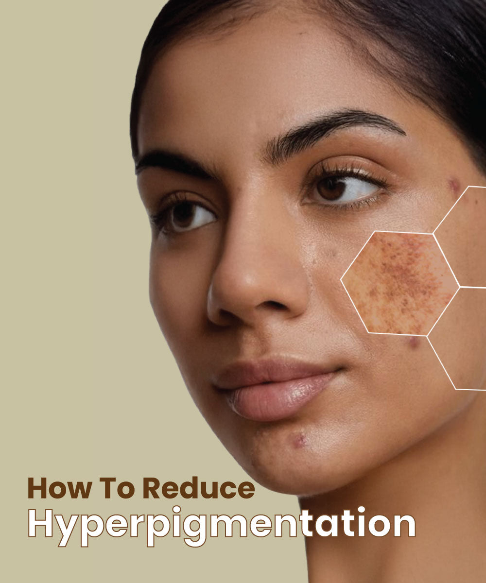how to reduce hyperpigmentation